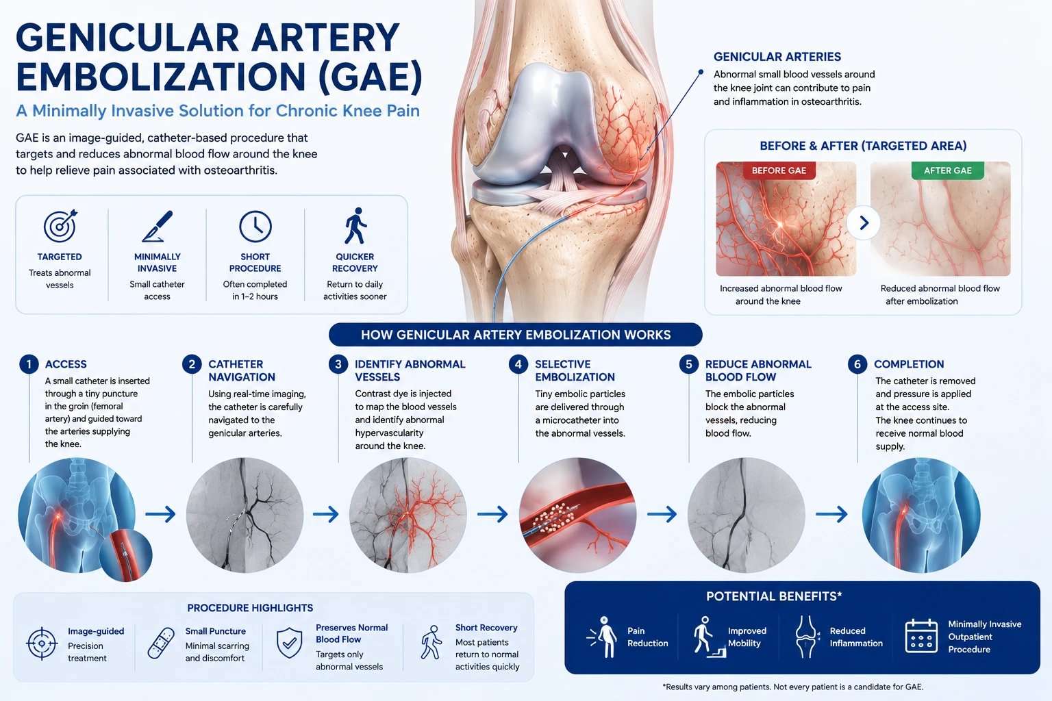 Genicular Artery Embolization procedure for chronic knee pain in Dubai