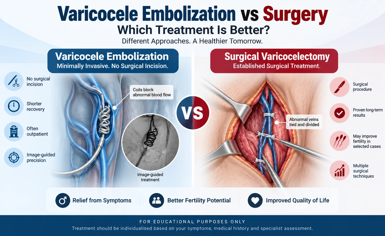 Varicocele Embolization vs Surgery