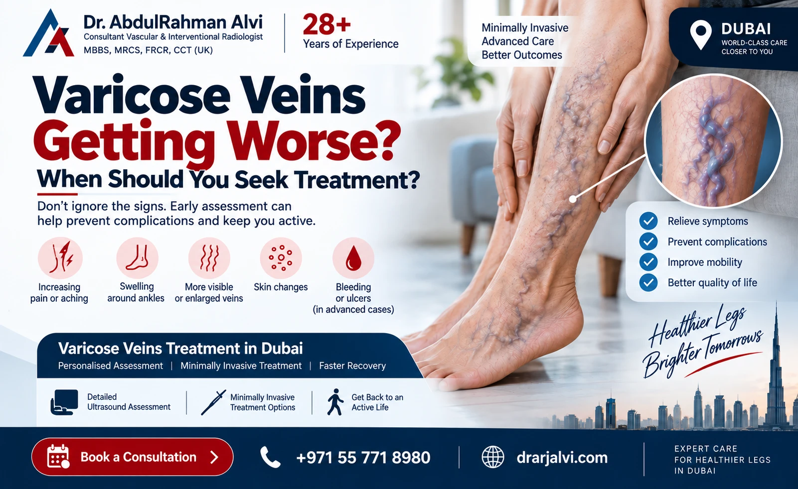 Varicose Veins Getting Worse