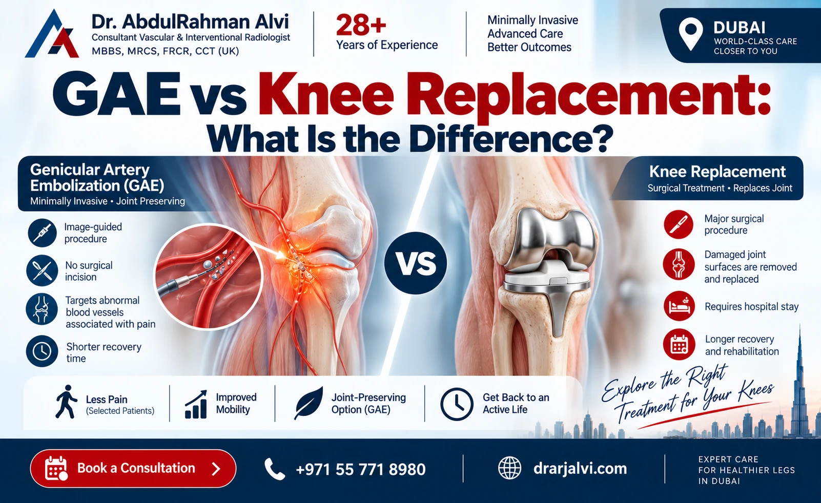 GAE vs Knee Replacement