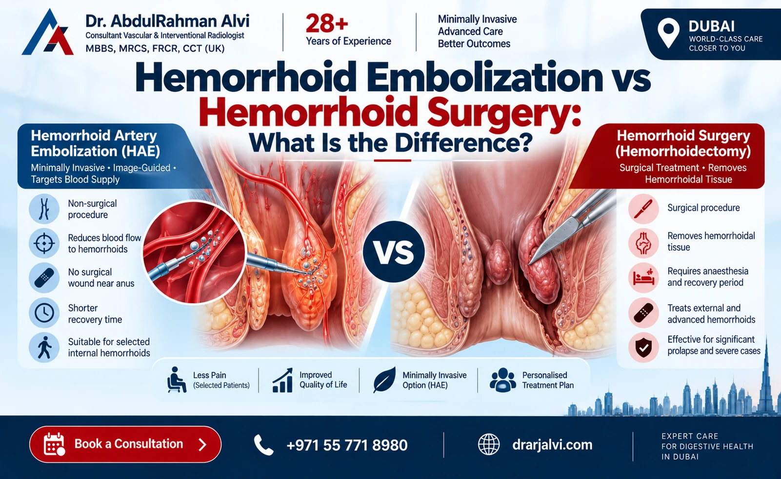 Hemorrhoid Embolization vs Surgery