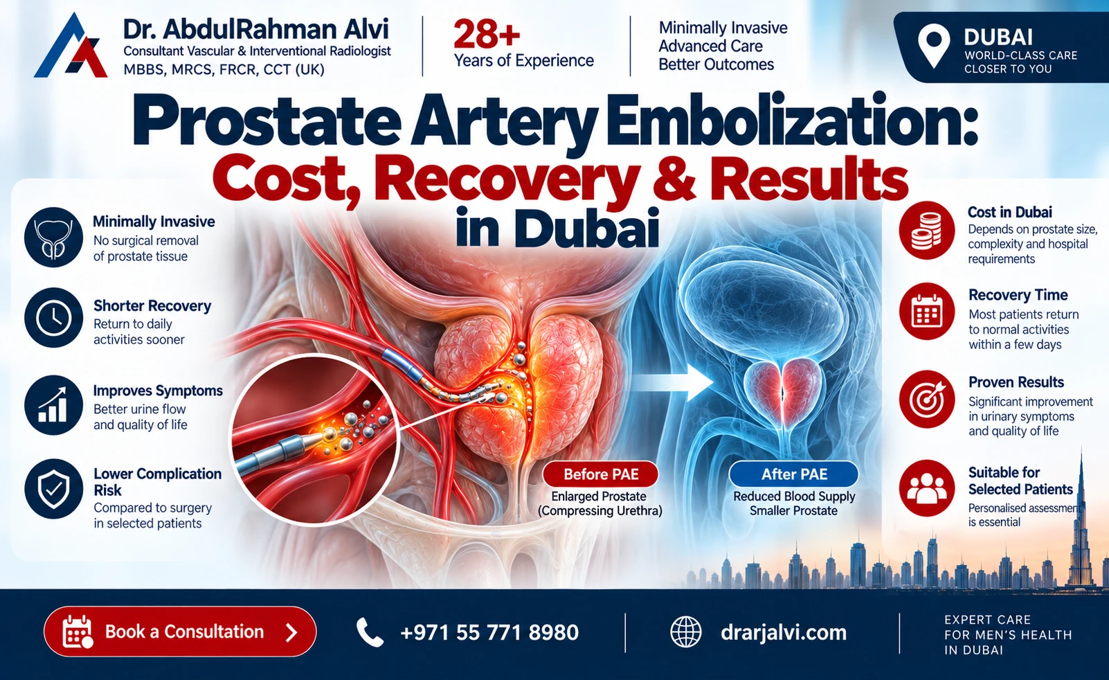 Prostate Artery Embolization Cost Dubai