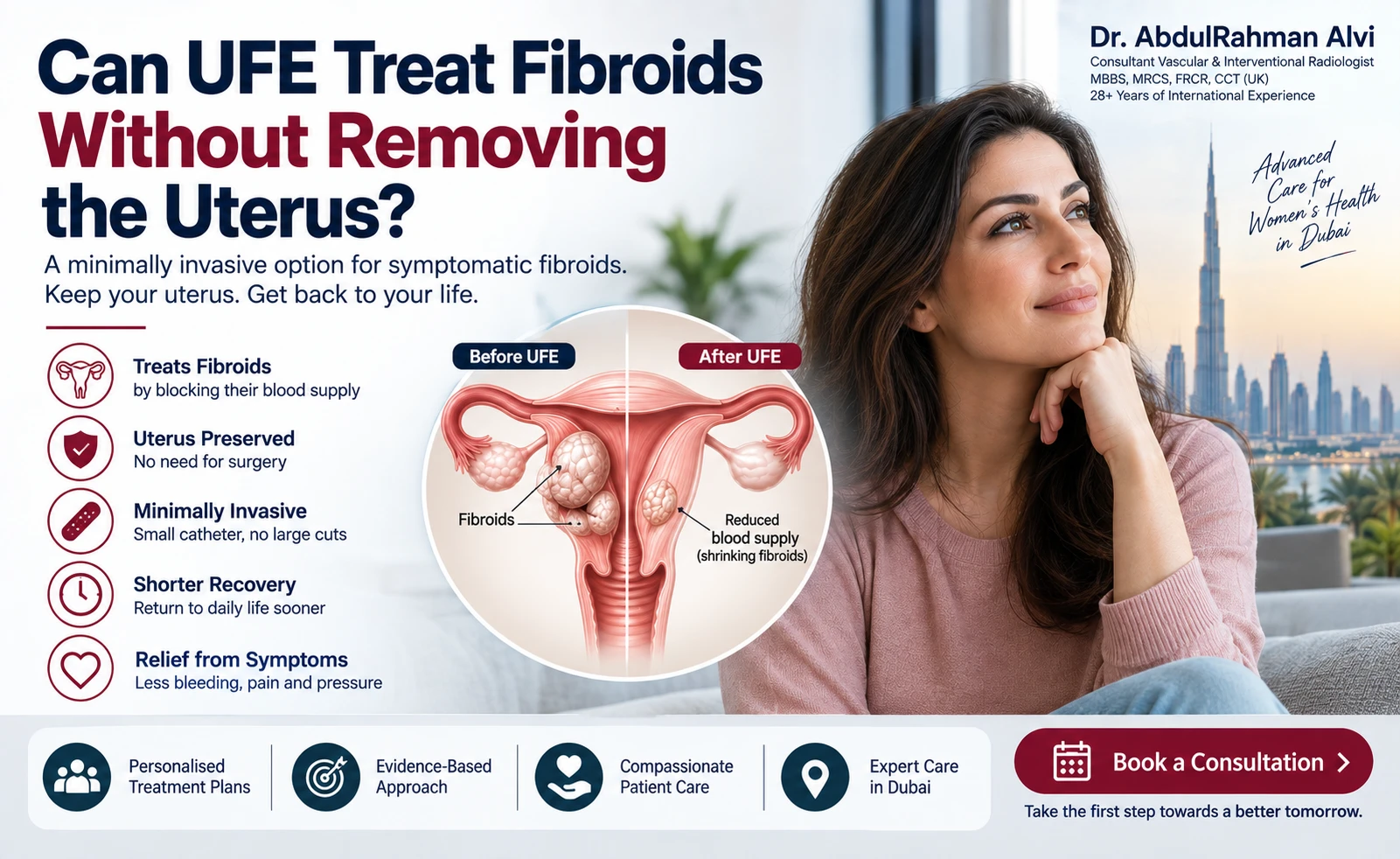 Can UFE treat fibroids without removing the uterus